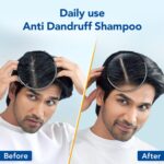 Scalpe Pro Daily Anti-Dandruff Shampoo | Removes Dandruff from Source | Prevents Itching & Irritation | Scalpe Science | Climbazole Formulation | Dermatologically Tested | For Women & Men | 200ml - Image 4