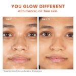 Foxtale Oil-Balancing Gel Moisturizer with Niacinamide, Azelaic Acid Pearls & Cica, 8hr Shine-Free Hydration, Lightweight, Sebum Control, For Oily & Acne-Prone Skin, 50 ml | For Men & Women - Image 7