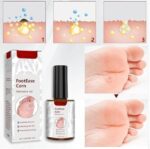 Corn Ease Foot Eliminator Gel | Fast-Acting, Pain-Free Corn & Callus Remover | Gentle Formula for Soft, Smooth Feet | Effective Corn Treatment Gel for Men & Women | 30ml - Image 3