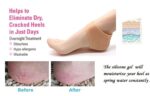 Purastep Silicone Gel Heel Pad Socks for Pain Relief - 1 Pair (Beige, Free Size) - Image 4