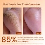 POKONUT - nurture with love Foot Care Cream For Dry And Cracked Heels | Aloe Vera And Turmeric Extract (50 G) | Moisturizes And Repair Feet | Intense Hydration And Nourishment For Women, Men - Image 4