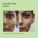 Plum Green Tea Pore Cleansing Face Wash for Oily, Acne Prone, Dry & Combination Skin | with Glycolic Acid | Fight Pimples & Control Excess Oil | Gentle Exfoliating & Non-Drying | Women & Men | 100ml - Image 4