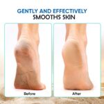 Midazzle 4 in 1 Feet Pedicure Tools with Foot Scrubber, Pumice Stone, Foot Rasp and Black Emery for Home Foot Care, Soft Care | Foot File Callus Remover - Multi Purpose Pedicure & Manicure Tool (MIFF5202) - Image 4