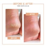 PROTOUCH Bliss Callus Remover | Rechargeable Electric Foot Scrubber for Dead Skin & Cracked Heels | 3 Roller Heads, 2 Speeds | Professional Pedicure Tool | 1 Year Doorstep Warranty - Image 6