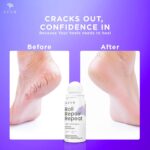 Azah 20% Urea Foot Roll on for Cracked Heels [50 ML] | 2% Lactic Acid, Olive Oil & Vitamin E | Dry and Crack Heel Repair Foot Cream | Exfoliates Dead Skin & Moisturise Repairs Rough Feet - Image 4