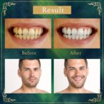 Natural Miswak stick toothbrush | Organic Miswak Teeth Cleaning Sticks | Herbal Chewing Stick Toothbrush Fresh Breath Oral Care | Natural Organic Datun Sticks | 6 Pcs - Image 4