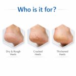 20% Urea Foot Cream Roll On 50ml | For Dry & Cracked Heels | With 5% Lactic Acid, Olive Oil & Vitamin E | Helps Repair and Moisturise Cracked Heels - Image 3