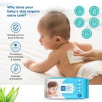 Mee Mee Soft Gentle Baby Wet Wipes (72 Wipes) Pack of 1 | Infused with Aloe Vera and Vitamin E | Paraben & Sulfate Free | Cleansing Wipes | Wipes for Babies - Image 4