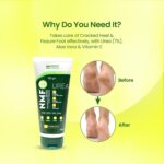 150 gm For Intense Moisturisation with Urea 7% & Aloe vera for thick and dry skin | Truly the Healing Moisturiser | For very dry skin | Takes care of cracked heels & Fissure feet effectively - Image 6