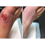 Diabetes Treatment Cream | Diabetic Skin Relief & Foot Care Cream | Heals Cracked Dry Skin & Promotes Circulation | Soothing Moisturizer for Neuropathy Itching & Numbness 50g (Pack of 2) - Image 3