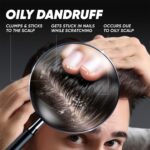 Head & Shoulders Deep Cleanse Anti Dandruff Shampoo with Oxygenated Charcoal, Fights Oily & Sticky Dandruff, Upto 100% Dandruff Protection, 650 ml - Image 5