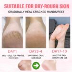 Urea Foot Hand Cream Stick for Cracked Heel Repair, Hydrating Foot Balm with Shea Butter, Coconut Oil, Aloe & Vitamin E, Moisturizing Peach Scent for Dry Dead Skin Care 40g - Image 7