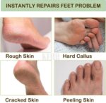 Silicone Gel Spa Socks for Women & Men – Moisturizing Heel Socks for Dry, Cracked Feet with Natural Oils & Vitamin E – Reusable Foot Care Socks for Heel Repair & Hydration – 1 Pair, Multicolor (Socks) - Image 3