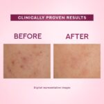 Pond's Bright Beauty Light Cream with UV Filter | Niasorcinol | 100x Better than Vitamin C | Niacinamide | Fades Dark Spots, Brightens Skin, 50g - Image 6