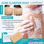 Acne Clarifier Soap with Tea Tree Oil, Alovera Extract, 2% Salicylic Acid, Vitamin E, 75g Bar for All Skin Types (1) - Image 3