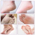 Besque Lavender Foot Peel Mask for Dead Skin Removal | Exfoliating Foot Spa Peel Mask for Dry, Cracked & Callused Feet | Deep Nourishing & Skin Renewal Foot Mask for Men & Women (5) - Image 3