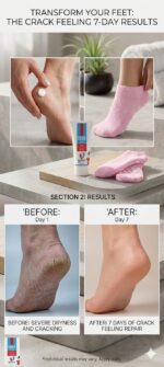 Varenza Moisturising Gel Heel Socks with Cracked Heel Repair Foot Cream | Deep Hydration for Dry, Cracked Heels | Overnight Foot Care for Soft & Smooth Feet (Multicolor) - Image 5