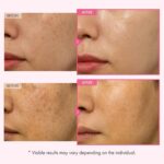 Arbutin 7% Glutathione Brightening Cream 70,000ppm Arbutin + 5,001ppm Glutathione with Niacinamide Helps Reduce Dark Spots, Dullness & Uneven Tone Korean Skincare 50ml (Pack of 1) - Image 3