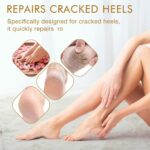 Moisturizing Silicone Spa Gel Socks for Women & Men – Crack Heel Repair Socks with Natural Oil & Vitamin E for Dry Cracked Feet (Pink, 1 Pair) - Image 6