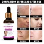 Nicotinamide Face Serum 30ml | Brightening & Dark Spot Corrector | Freckle & Pigmentation Care | Moisturizing Serum for Even Skin Tone - Image 4