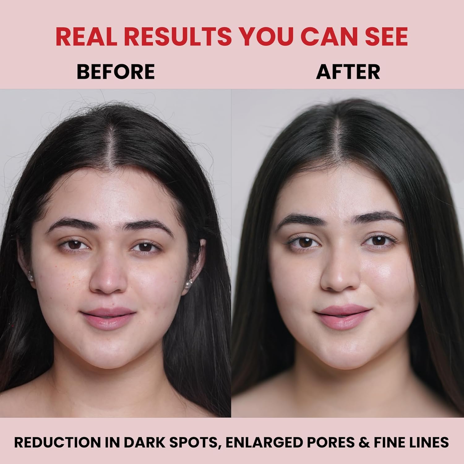 Carbamide Forte Bio Collagen Mask | Collagen Mask Overnight | Sheet Mask | Korean Glass Skin Overnight Hydrogel Face Mask Sheets for Deep Hydration, Pore Minimizing, Firming & Moisturizing | Paraben-Free | For All Skin Types | 1 Piece - 35g - Image 5