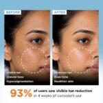 Clarity Labs | DETAN BRIGHTENING SOAP | (Pack of 4) | Tan Removal | KOJIC ACID SOAP | Niacinamide | Vitamin C Kojic | Dark Spot Removal | Even Skin Tone | Glowing Brighter Skin | Reduces underarm pigmentation - Image 3