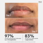Deyga Beetroot Lip Balm | Lip Care | For Dry & Chapped Lips | For Pigmented Lips | For Women & Men (Classic Lip Balm - Pack of 1) - Image 3
