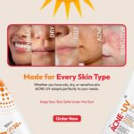 New Acne-UV Gel Sunscreen SPF 30 PA+++ | Sunscreen for Oily Skin Women & Men | Non-Comedogenic Sunscreen | Silicone Gel | Visible Light Protection | Water Resistant | Suitable for All Skin Types - Image 6