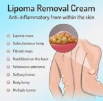 Lipoma Removal Cream – Advanced Whole Body Fat Lump & Lipoma Reduction Formula | Gentle Multi-Use Cream for Neck, Shoulders, Arms, Legs & Body (20gm, Pack of 1) - Image 4