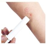 2PK Bug Bee Snake Bite Sting Kit Suction Tool Safety Emergency First Aid Supplies Tool Natural Bite Sting First Aid for Hiking Backpacking Camping - Image 2