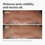 The Ordinary Niacinamide 10% + Zinc 1%, Brightening & Smoothing Serum - Image 3