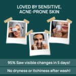 Anti Bacterial Bath Body Soap-Sulphate & Paraben Free, Anti Acne Soap for Body, pH 5.5 Tea Tree Oil, Aloe Vera, Bamboo Charcoal, Bath Soap for Men, Women for Acne-Prone, Oily Skin, Pack of 2 - Image 10