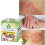 Suvarnamani Ayurvedic Ointment, Herbal Skin Care Cream for Dry, Itchy and Irritated Skin, Moisturising, Daily Use, 25g (Pack of -1) - Image 5