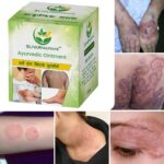 Suvarnamani Ayurvedic Ointment, Herbal Skin Care Cream for Dry, Itchy and Irritated Skin, Moisturising, Daily Use, 25g (Pack of -1) - Image 6