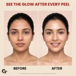 Carbamide Forte Collagen Peel Off Mask for Korean Glass Skin | Collagen mask overnight with Hyaluronic Acid, Niacinamide & Ceramide NP | Pore Minimizing, Firming & Skin Brightening Mask | For All Skin Types | 100 ml - Image 6