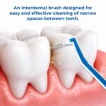 ICPA Interdental Manual Thermoseal Proxa Narrow Space Brush For Adult | Dental Brush | Easy Cleaning between teeth (Multicolor, Pack of 2) - Image 3