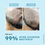 Hyphen Clarifying Acne Face Wash for Women and Men | Cleanser For Acne Prone Skin with Salicylic Acid 2%, Zinc PCA, Witch Hazel 10% | Oil Control Pore Cleasning | Antibacterial & Non-Drying - 100ml - Image 4