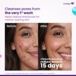 Dr. Reddy's Venusia Acne Facewash | Sebum Control & Hydrating Formula | Clears Acne-marks | Enriched with encapsulated Salicylic Acid, Glycolic Acid, Ceramide - Oat - HA Complex | Oily & Acne-Prone Skin | 75g - Image 9