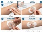 Closure Support Strips – Compact Adhesive Skin Support Strips for Outdoor, Travel & Emergency Preparedness Kits - Image 3