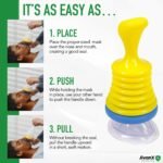Anti-Choking Device – Choking Rescue Suction Kit for Kids & Adults | First Aid Airway Clearing Device for Home, Travel & Emergency Use | Includes Emergency Instruction Manual | Improved Section Power - Image 5